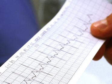 Egy férfi egy EKG-eredményt tart a kezében