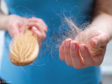 egy nő nagyon sok hajat szed ki a fésűből