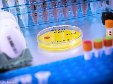 labor vizsgálat kémcsövek vírus