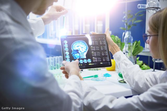Orvosok az agy MRI felvételét nézik egy laborban, amiben sok a növény