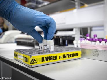 veszélyes anyag vizsgálat kéz gumikesztyű fertőzés