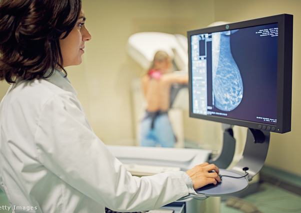 Emlőmirigy MRI felvételét nézi egy orvosnő a számítógépen.